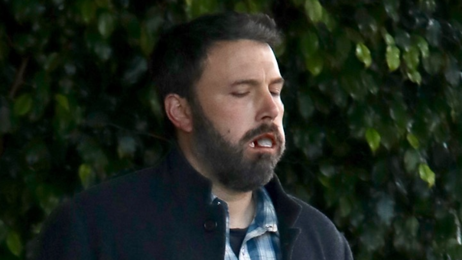 Ben Affleck in pain