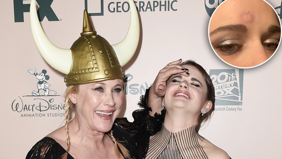 Patricia Arquette Accidentally Hit Joey King With Her Golden Globe