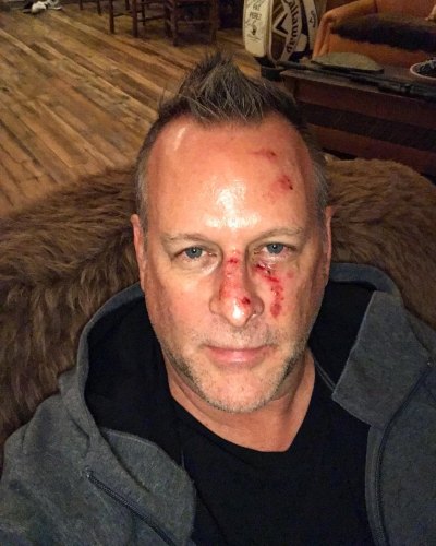 Dave Coulier Shares Graphic Photo for Sobriety Message: ‘I Was a Drunk’  