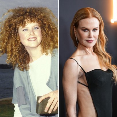 Has Nicole Kidman Had Plastic Surgery See Transformation Photos 094